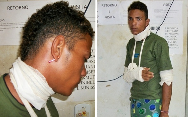 Ap&oacute;s o assalto Maicon foi baleado pelos pr&oacute;rpios comparsas.