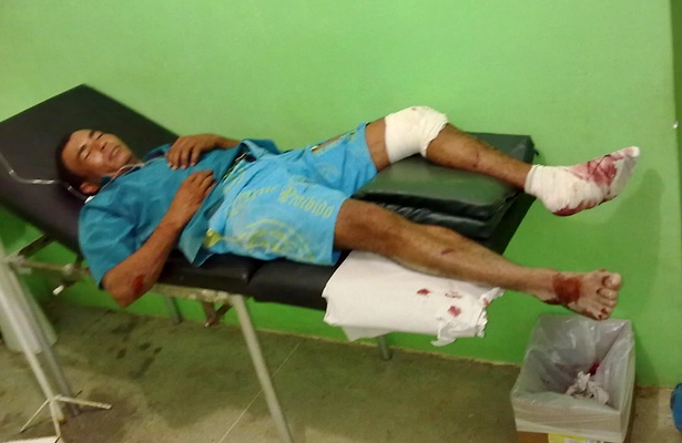 O senhor Genivaldo foi socorrido, conduzido ao hospital e passa bem (Fotos: Giro de Not&iacute;cias)